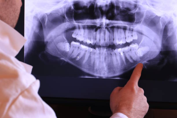 Best Holiday Emergency Dentist in Laughlin Af, TX