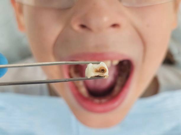 Best Urgent Dental Care for Toothache in Laughlin Af, TX
