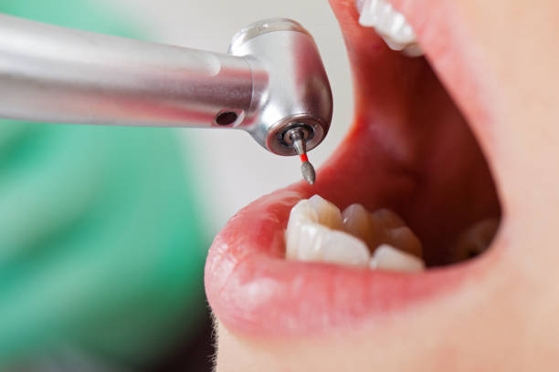 Best Emergency Dentist for Lost Fillings or Crowns in Laughlin Af, TX